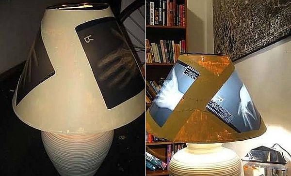 X-Ray Lamp By Individual Lamp